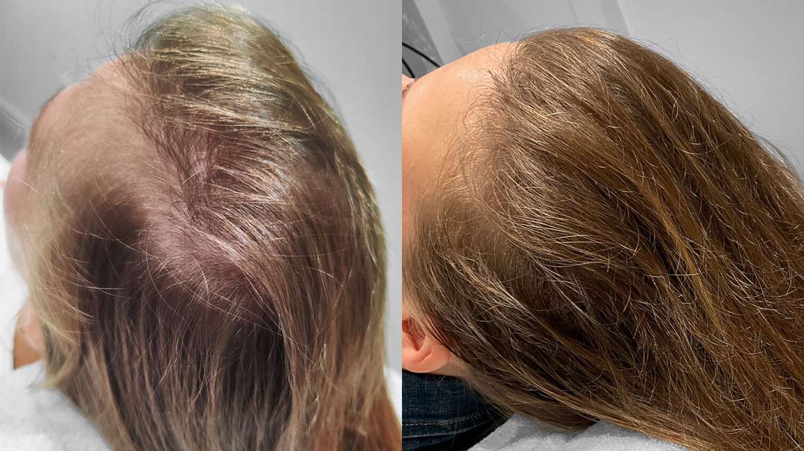 Ervaring-XL-Hair-dames2