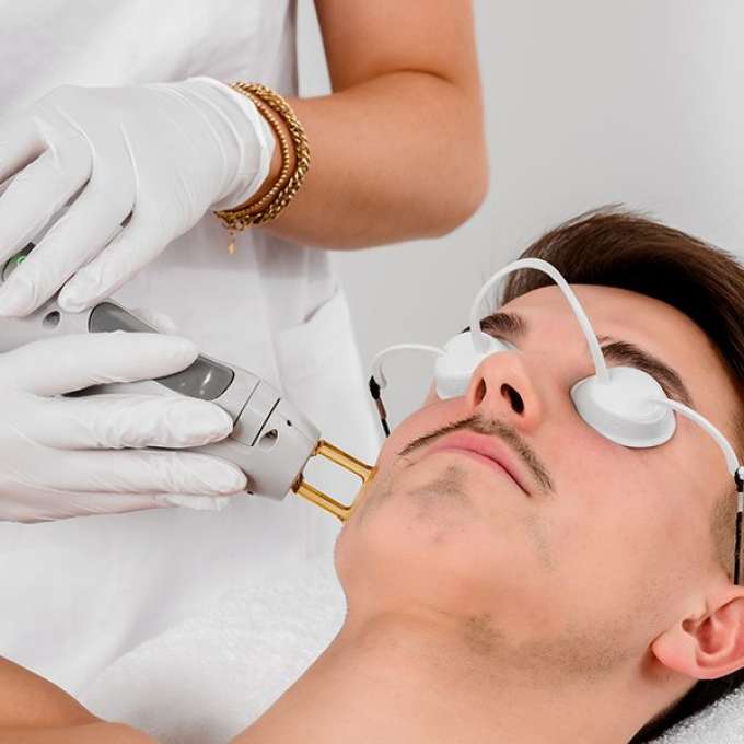 Werkwijze baard laseren