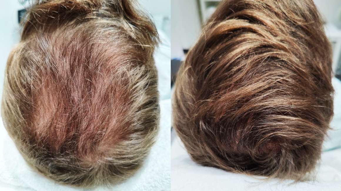 Ervaring-XL-Hair-heren